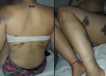 Intentó matar a su pareja frente a su pequeño hijo: la víctima fue hospitalizada