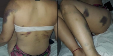 Intentó matar a su pareja frente a su pequeño hijo: la víctima fue hospitalizada