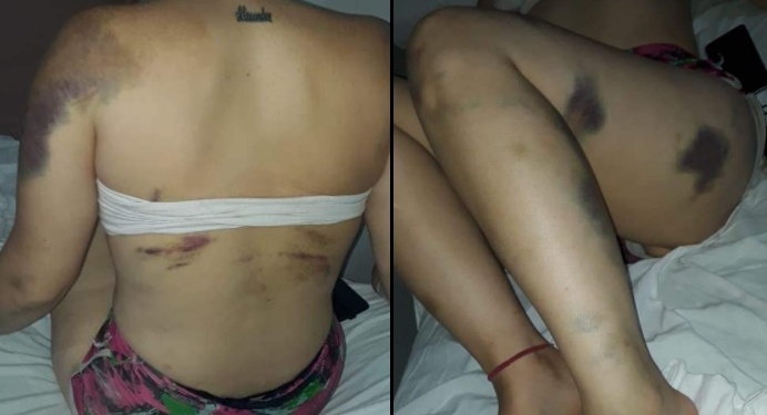 Intentó matar a su pareja frente a su pequeño hijo: la víctima fue hospitalizada