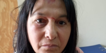 San Genaro: denunciaron a una mujer que agredió brutalmente a otra
