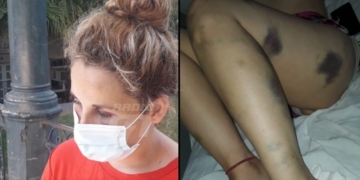 Florencia fue operada y relató el intento de femicidio: «Me duele hasta el alma»