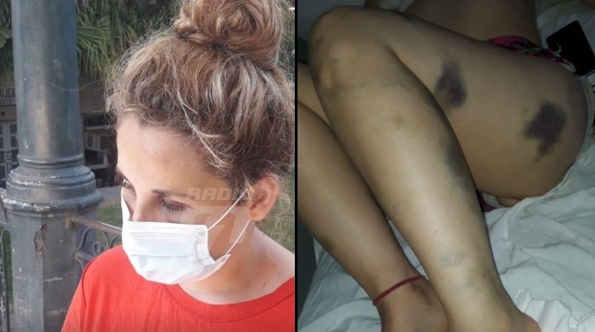 Florencia fue operada y relató el intento de femicidio: «Me duele hasta el alma»