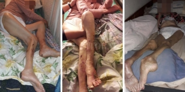 Hallaron a abuelos en estado de abandono en un geriátrico y detuvieron a la dueña