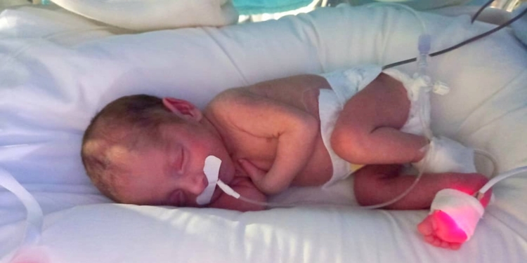 Olivia es de Salto Grande, nació prematura y necesitan reunir 200 mil pesos