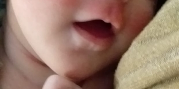 Maciel: lanzaron una rifa con 25 premios para ayudar a Dante y sus papás