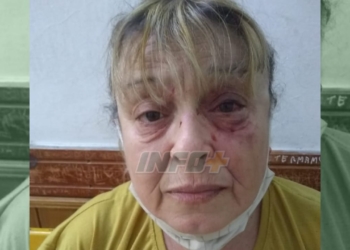 Una joven atacó ferozmente a una mujer en San Genaro