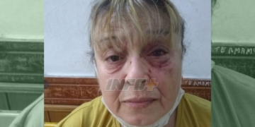 Una joven atacó ferozmente a una mujer en San Genaro