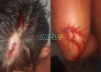 Apuñalaron a un menor de 17 años en San Genaro: recibió 30 puntos de sutura