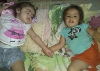 Pedido solidario para dos mellizas de Andino: una de ellas sufrió meningitis