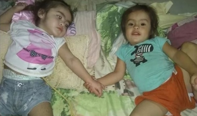 Pedido solidario para dos mellizas de Andino: una de ellas sufrió meningitis