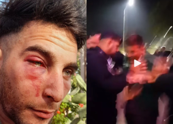 Un muchacho denunció una brutal golpiza en un boliche de la región