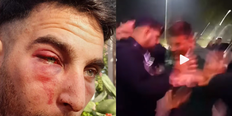 Un muchacho denunció una brutal golpiza en un boliche de la región