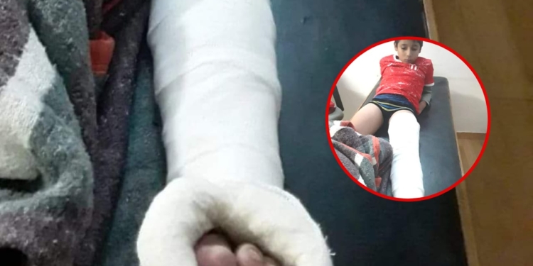 Un futbolista de 9 años sufrió doble fractura en Serodino y lo atendieron tras 5 horas