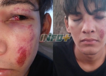 Una patota atacó brutalmente a un joven en Timbúes: terminó internado
