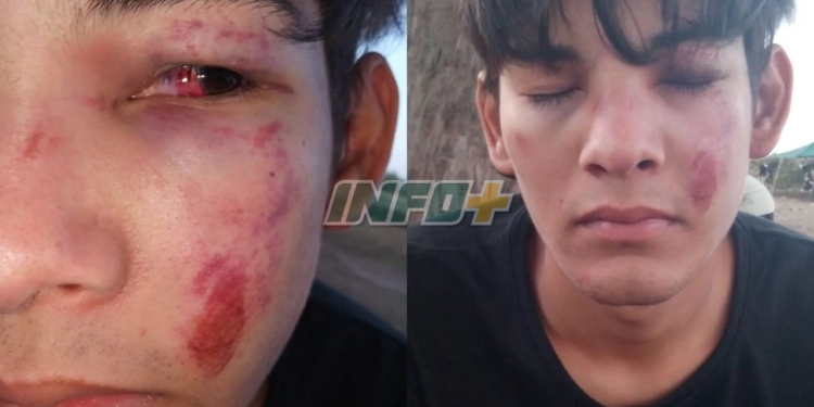 Una patota atacó brutalmente a un joven en Timbúes: terminó internado