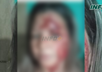 Una mujer de Díaz golpeó a su cuñada en la cabeza con un fierro