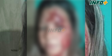 Una mujer de Díaz golpeó a su cuñada en la cabeza con un fierro