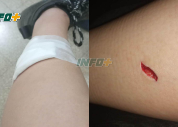 Monje: un menor arrojó una botella de vidrio e hirió a dos chicas de Maciel