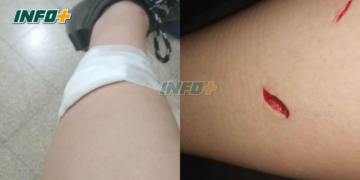 Monje: un menor arrojó una botella de vidrio e hirió a dos chicas de Maciel