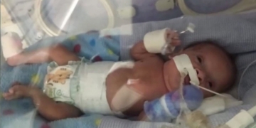Nació prematuro y necesita ayuda para vivir en una casa adecuada: «Dijeron que no iba a vivir»