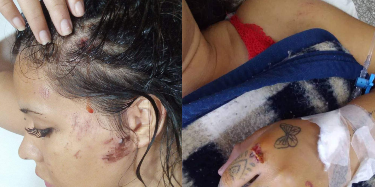 La joven atropellada en Timbúes se recupera de las heridas: “La puedo contar”