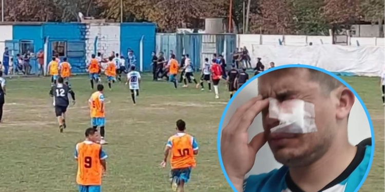 Otro escándalo en la Liga Sanlorencina: un jugador herido por un piedrazo
