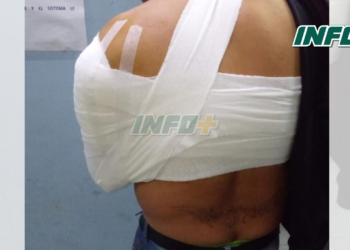 Timbúes: lo acusó de agredir a su hermana y lo apuñaló por la espalda