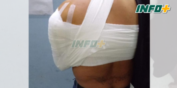 Timbúes: lo acusó de agredir a su hermana y lo apuñaló por la espalda