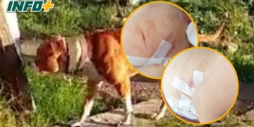 Grave ataque de un perro a una niña en San Genaro: debieron suturarla