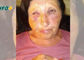 Gaboto: una mujer fue brutalmente atacada a la salida de un supermercado