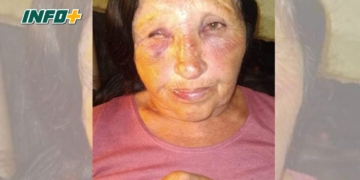 Gaboto: una mujer fue brutalmente atacada a la salida de un supermercado