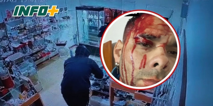 Volvieron a asaltar y a golpear al joven de Gaboto en su local de celulares
