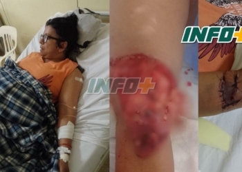 Una mujer fue atacada por cinco perros en San Genaro: fue internada y necesita ayuda