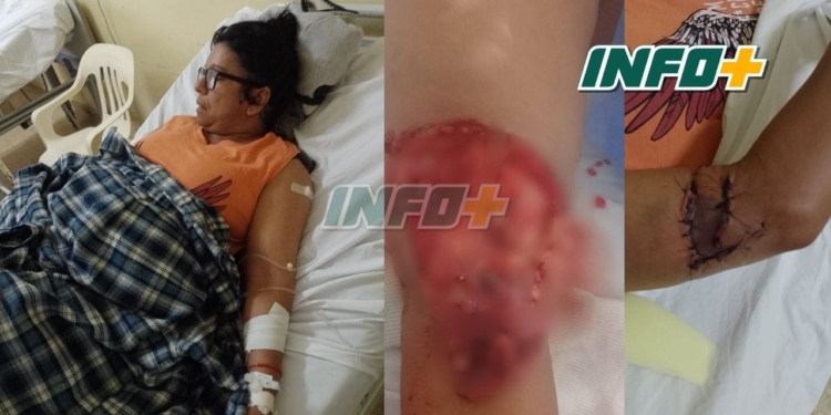 Una mujer fue atacada por cinco perros en San Genaro: fue internada y necesita ayuda