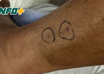 Un hombre de San Genaro fue mordido por una yarará en la isla frente a Puerto Aragón