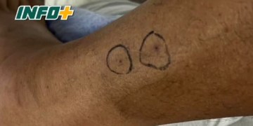 Un hombre de San Genaro fue mordido por una yarará en la isla frente a Puerto Aragón