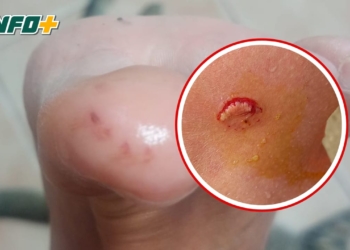 Palometas en la región: advierten por un caso de mordeduras en el Río Paraná