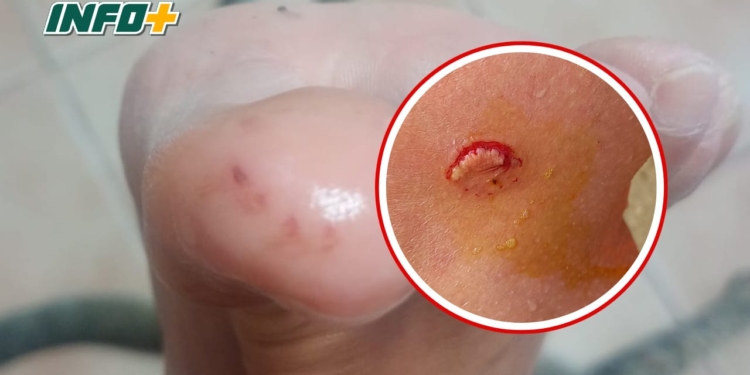 Palometas en la región: advierten por un caso de mordeduras en el Río Paraná