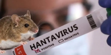 Detectaron un caso de hantavirus en San Lorenzo y el paciente fue internado