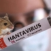 Detectaron un caso de hantavirus en San Lorenzo y el paciente fue internado